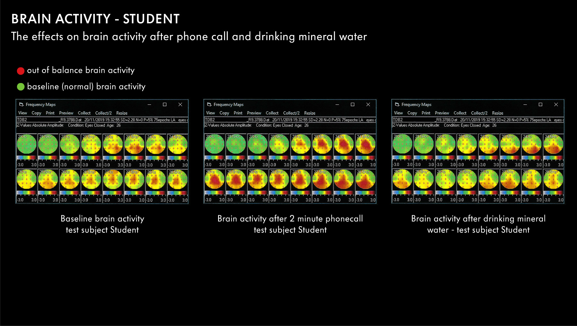 Brain-Activity-Student-01